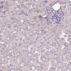 Immunohistochemical staining of human liver shows low expression as expected.