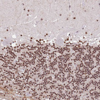 Immunohistochemical staining of human cerebellum shows moderate nuclear positivity in cells in granular layer.