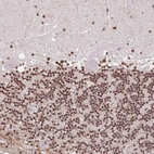 Immunohistochemical staining of human cerebellum shows moderate nuclear positivity in cells in granular layer.