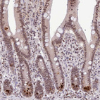 Immunohistochemical staining of human duodenum shows moderate nuclear positivity in glandular cells.
