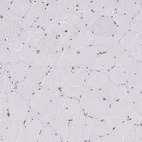 Immunohistochemical staining of human skeletal muscle shows weak nuclear positivity in myocytes.