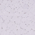 Immunohistochemical staining of human skeletal muscle shows weak nuclear positivity in myocytes.