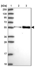 Lane 1: Marker [kDa] 250, 130, 95, 72, 55, 36, 28, 17, 10_br/_Lane 2: Human cell line RT-4_br/_Lane 3: Human cell line U-251MG sp