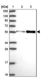 Anti-PDK3 Antibody