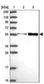 Lane 1: Marker [kDa] 250, 130, 95, 72, 55, 36, 28, 17, 10_br/_Lane 2: Human cell line RT-4_br/_Lane 3: Human cell line U-251MG sp