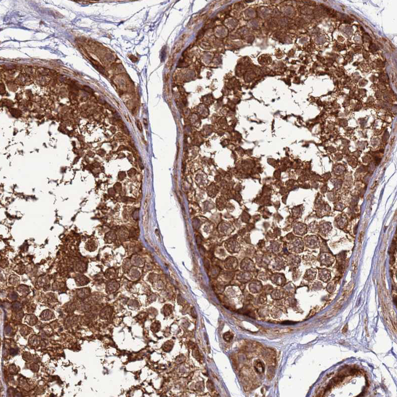 Anti-CNOT1 Antibody