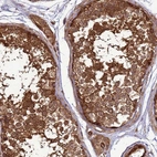 Anti-CNOT1 Antibody