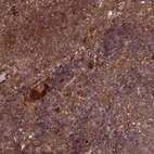 Immunohistochemical staining of human tonsil shows strong cytoplasmic positivity in non-germinal center cells.