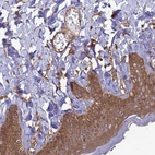 Immunohistochemical staining of human skin shows moderate cytoplasmic positivity in squamous epithelial cells and endothelial cells.