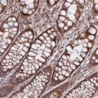 Immunohistochemical staining of human colon shows moderate cytoplasmic positivity in glandular cells.