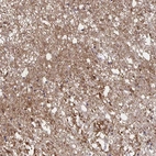 Anti-CX3CR1 Antibody