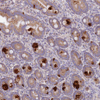 Immunohistochemical staining of human duodenum shows strong cytoplasmic positivity in glandular cells.