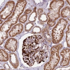 Immunohistochemical staining of human kidney shows strong cytoplasmic positivity in cells in glomeruli and cells in tubules.