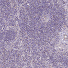 Anti-ALS2 Antibody