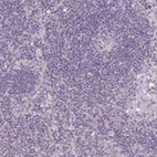 Immunohistochemical staining of human lymph node shows weak cytoplasmic positivity in germinal center cells.