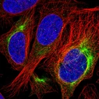Immunofluorescent staining of human cell line U-2 OS shows localization to intermediate filaments.