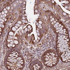 Anti-RHBDL1 Antibody