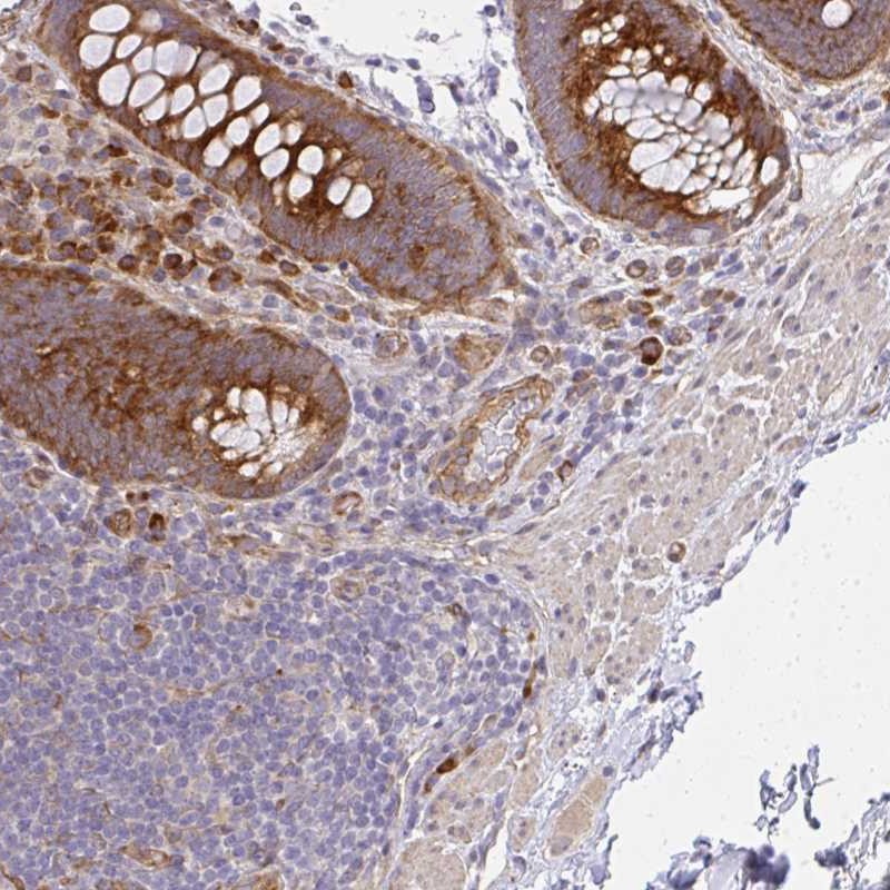 Anti-SGK494 Antibody