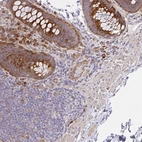 Anti-SGK494 Antibody