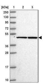 Lane 1: Marker [kDa] 250, 130, 95, 72, 55, 36, 28, 17, 10_br/_Lane 2: Human cell line RT-4_br/_Lane 3: Human cell line U-251MG sp