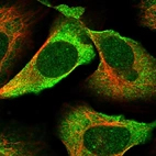 Immunofluorescent staining of human cell line U-2 OS shows localization to plasma membrane.