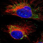Immunofluorescent staining of human cell line HeLa shows localization to mitochondria.