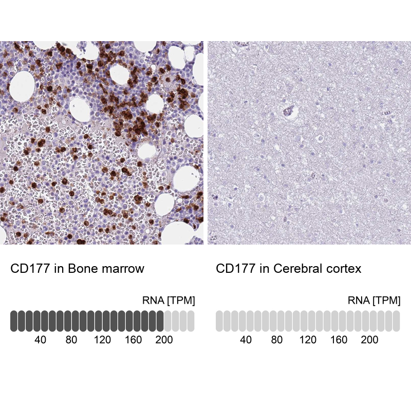 Anti-CD177 Antibody