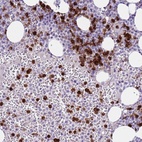 Anti-CD177 Antibody