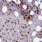 Immunohistochemical staining of human bone marrow shows high expression.