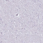 Immunohistochemical staining of human cerebral cortex shows low expression as expected.