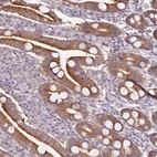 Anti-CNOT9 Antibody