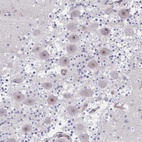 Anti-CENPQ Antibody
