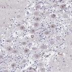 Anti-CENPQ Antibody