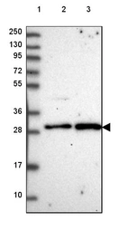 Lane 1: Marker [kDa] 250, 130, 95, 72, 55, 36, 28, 17, 10_br/_Lane 2: Human cell line RT-4_br/_Lane 3: Human cell line U-251 MG