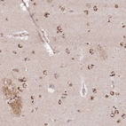 Anti-AF165138.7 Antibody
