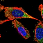 Immunofluorescent staining of human cell line PC-3 shows localization to nucleoli & cytosol.