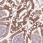 Anti-FLVCR1 Antibody