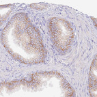 Immunohistochemical staining of human prostate shows moderate membranous positivity in glandular cells.