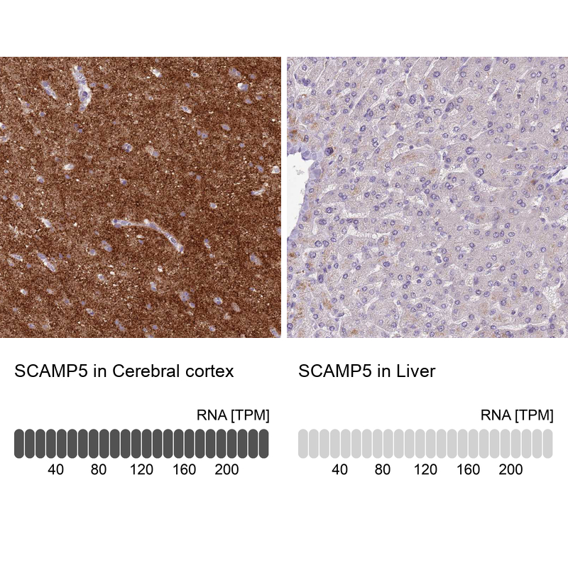 Anti-SCAMP5 Antibody