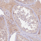 Immunohistochemical staining of human testis shows moderate membranous positivity in cells in seminiferous ducts.
