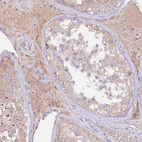 Anti-FLVCR1 Antibody