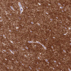 Immunohistochemical staining of human cerebral cortex shows strong positivity in neuropil.