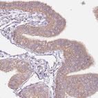 Immunohistochemical staining of human fallopian tube shows moderate membranous positivity in glandular cells.