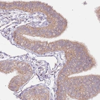 Immunohistochemical staining of human fallopian tube shows moderate membranous positivity in glandular cells.