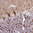 Immunohistochemical staining of human cerebellum shows strong granular cytoplasmic positivity in Purkinje cells and cells in granular layer.