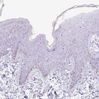 Immunohistochemical staining of human skin shows no positivity in squamous epithelial cells as expected.
