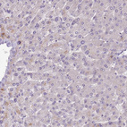 Immunohistochemical staining of human liver shows no positivity in hepatocytes as expected.