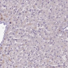 Immunohistochemical staining of human liver shows no positivity in hepatocytes as expected.