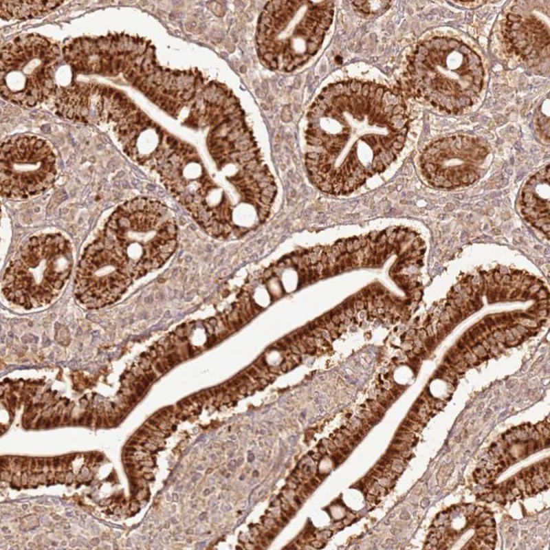 Anti-ZNF776 Antibody
