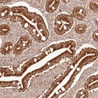 Anti-ZNF776 Antibody